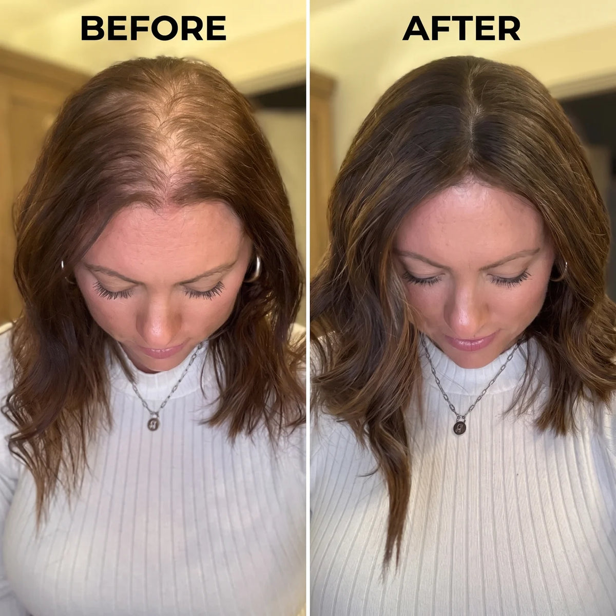 Advanced Hair Growth Roll-on Serum