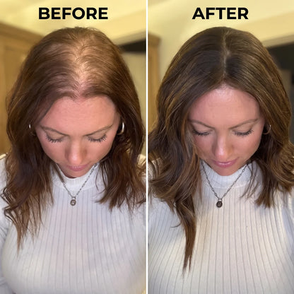 Advanced Hair Growth Roll-on Serum